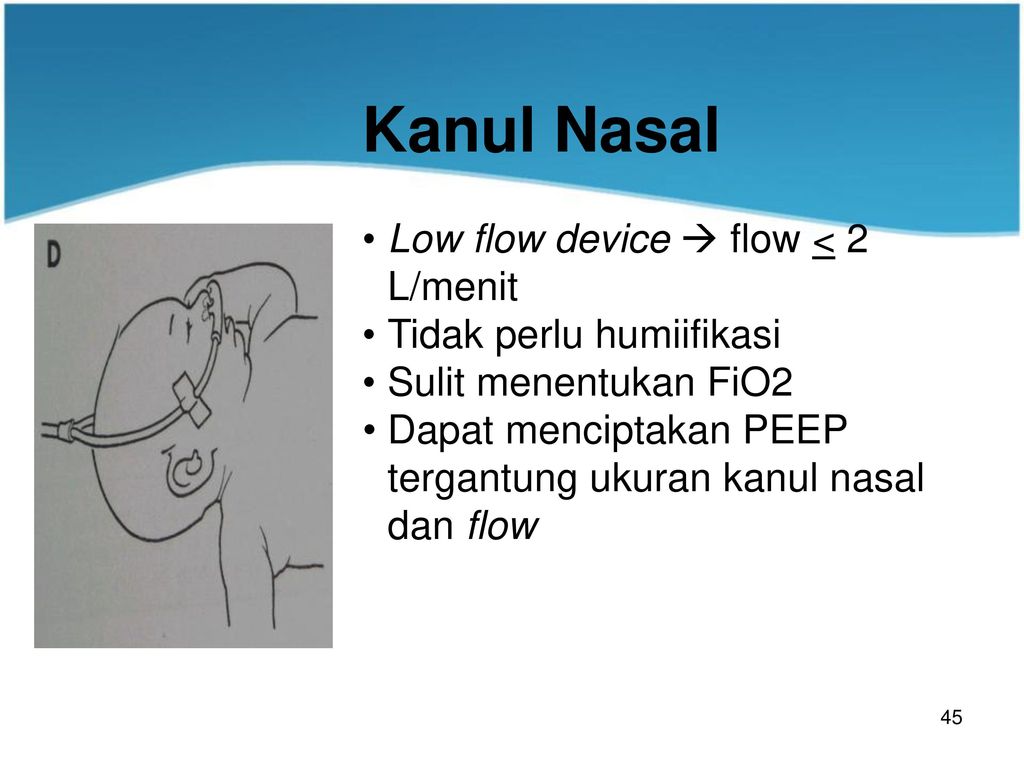 Afluon nasal para que sirve